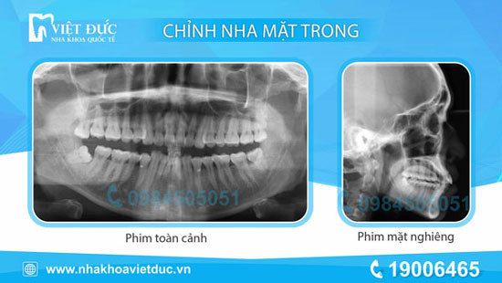 khach-nieng-rang-mat-trong-6
