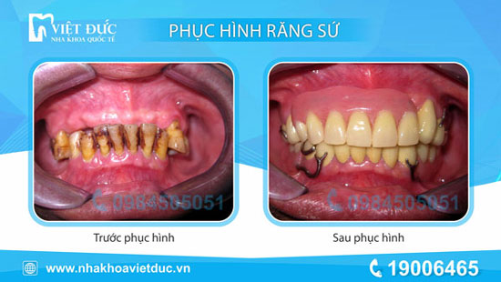 khach-hang-phuc-hinh-thao-lap