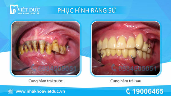 khach-hang-phuc-hinh-thao-lap-2
