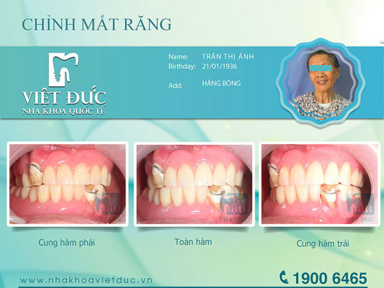 khach-hang-phuc-hinh-thao-lap-3