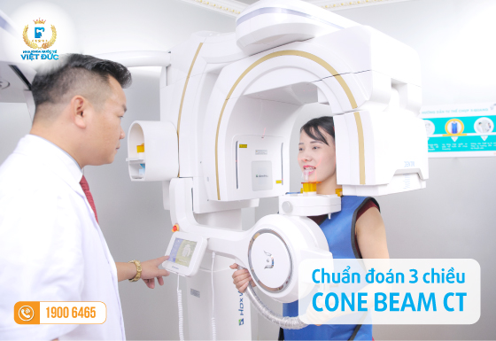 may-cone-beam