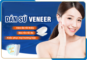 DÁN SỨ VENEER