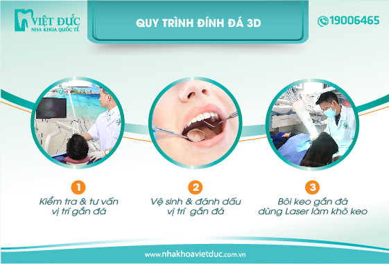 quy-trinh-dinh-da-tham-my