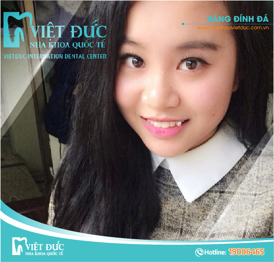 khach-hang-dinh-da-tham-my
