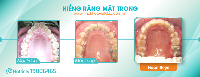 Nieng rang mat trong-10