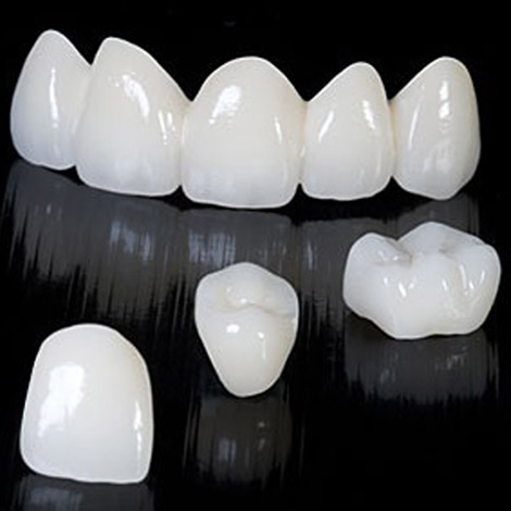 rang-su-cercon-co-may-loai-2