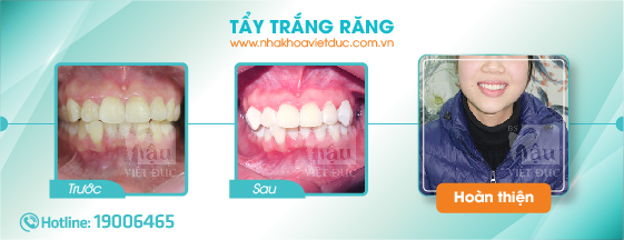 khach-hang-tay-trang-rang2