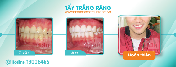 khach-hang-tay-trang-rang3