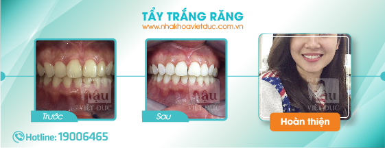 khach-hang-tay-trang-rang5