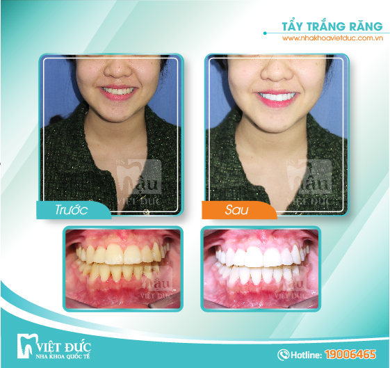 khach-hang-tay-trang-rang