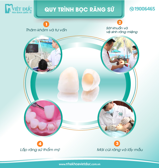 quy-trinh-boc-rang-su