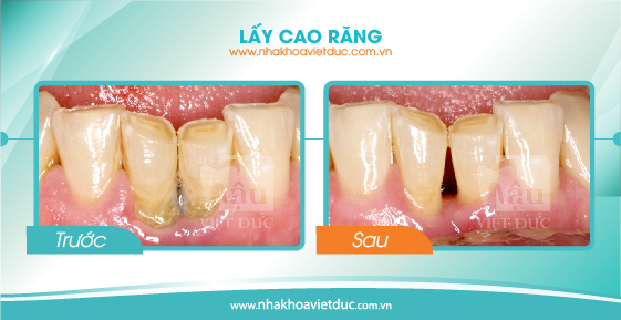 khach-hang-lay-cao-rang1