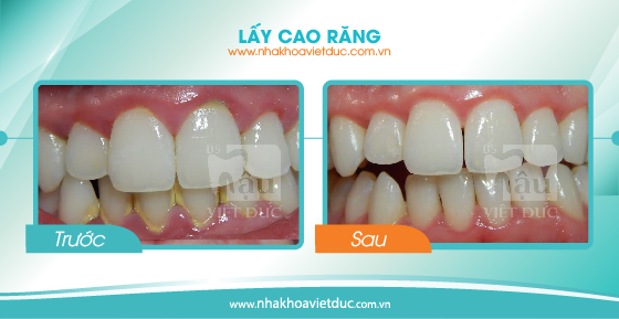 khach-hang-lay-cao-rang2