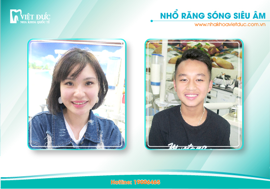 khach-hang-nho-rang1