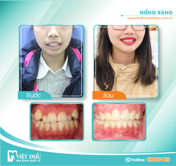 khach-hang-nieng-rang2