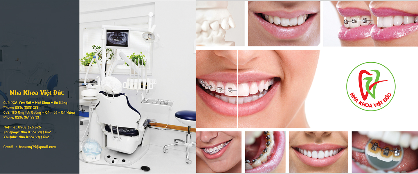 Dịch Vụ Nha Khoa Tại Phòng Khám Việt Đức